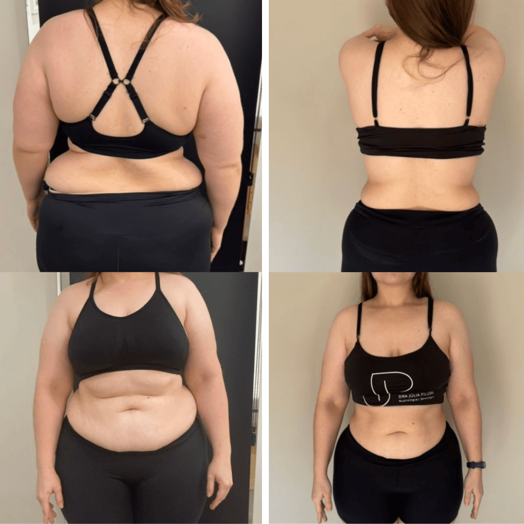 Resultado de transformação 3